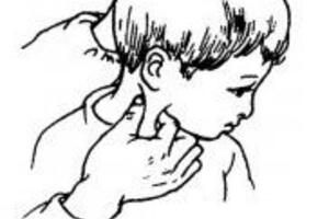 Điều trị vẹo cổ bẩm sinh do cơ ức đòn chũm bị co rút