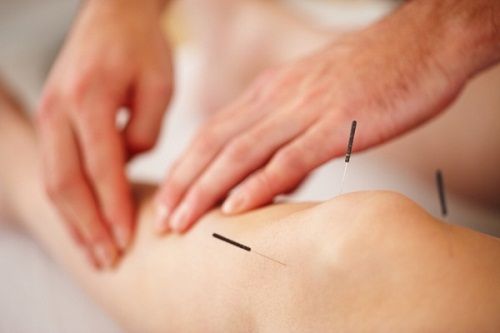 Phương pháp châm cứu mang lại hiệu quả cao trong việc điều trị xương khớp